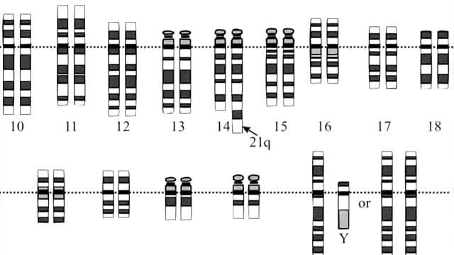 مقایسه ساختمان DNA و RNA