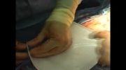 surgiwrap in c-section