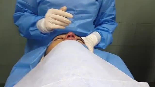 دکترراستا:2- جراحی بینی بعد از عمل