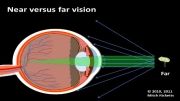 eye vision