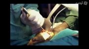 مستند پزشکان بی همتا - ربات های جراح