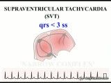 25 ECGTeacher.com - Tachycardia - Part 1 (Section 4_ Part 4)