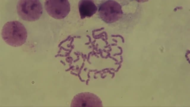 سیتوژنتیک - کاریوتایپ کروموزوم های انسان