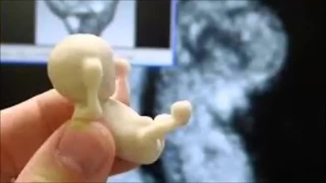 پرینت  جنین سه بعدی
