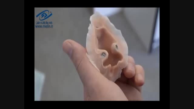 چاپ گر سه بعدی با چاپ اعضای بدن با سلول بدن بیمار