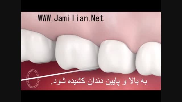 استفاده از نخ دندان در رعایت بهداشت دهان و دندا ن