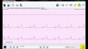نرم افزار تحلیل سیگنال هولتر ECG نسخه 3 -  جستجوی سریع