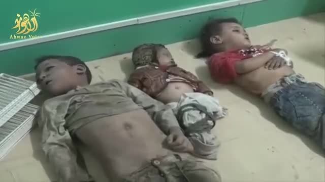 جنایت جدید آل سعود صهیونیست علیه کودکان در یمن 18+