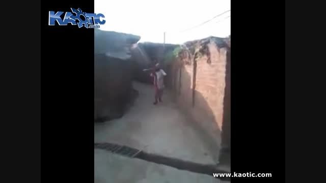 ویدیو وحشتناک از فرور رفتن بیل در کتف یک نفر