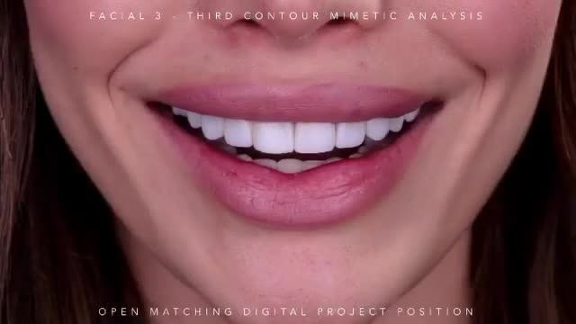 طراحی لبخند دیجیتال