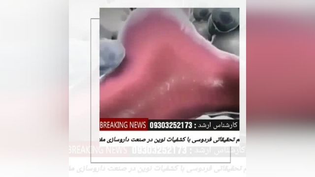 کشف داروی درمان قطعی پسوریازیس در ایران برای اولین بار در ایران