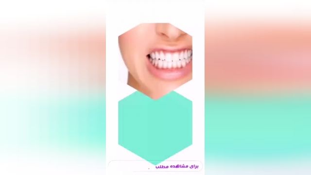 دندان قروچه_کلینیک توانبخشی یاشا09901417763