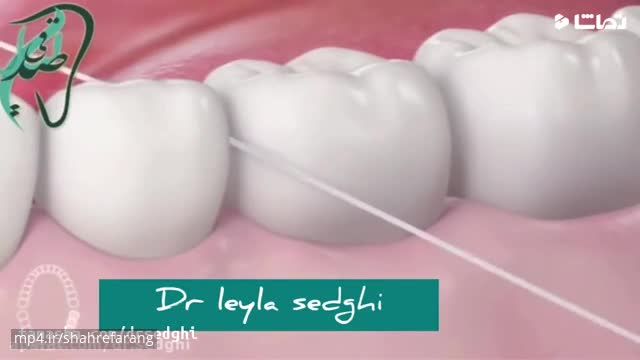 طرز استفاده درست از نخ دندان بدون اسیب زدن به دندان ها 