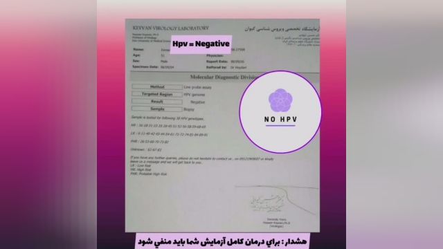 درمان زگیل تناسلی زیر نظر کادر درمانی فردوسی