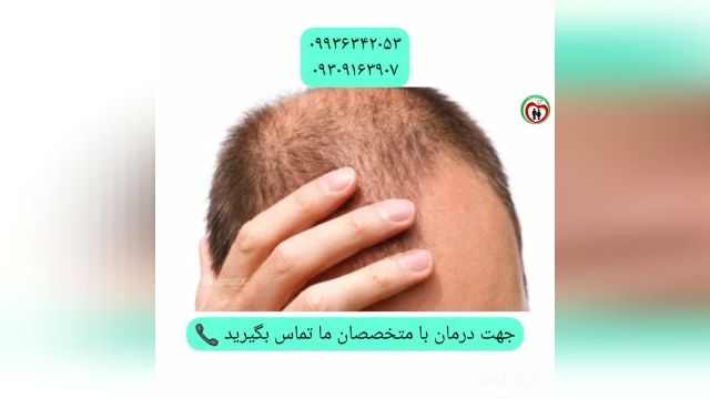 درمان ریزش مو و رویش مجدد موها