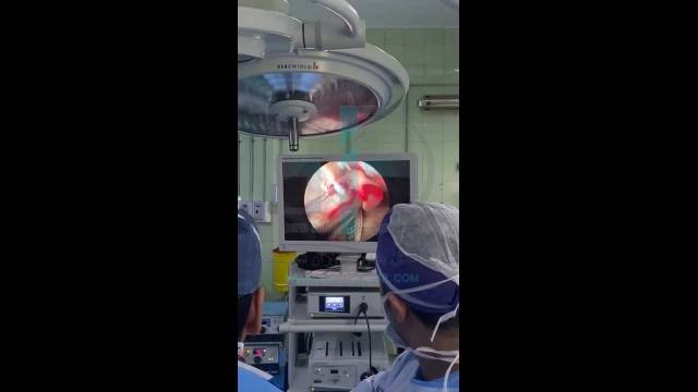  عمل جراحی دکتر رضا اشراقی با دوربین پزشکی  Surgical Camera