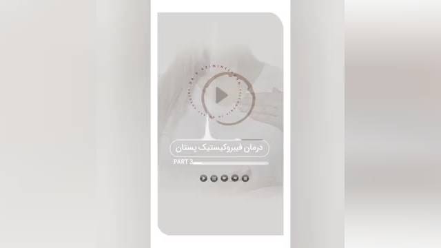 درمان فیبروکیست به چه صورت است ؟- پارت 3