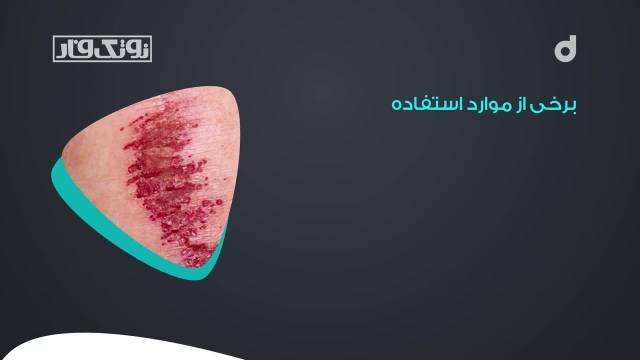 معرفی شامپو بابونه آلمانی