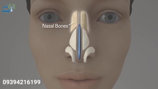 فیلم جراحی عمل بینی نوک گرد
