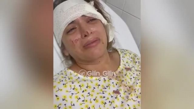 ضرب و شتم پناهجوی زن ایرانی به دست صاحبخانه‌اش در قبرس | صحنه دلخراش