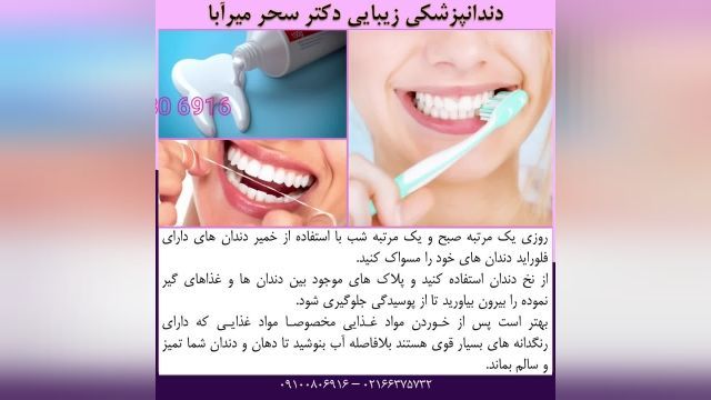  مراقبت های لازم بعد از کامپوزیت دندان