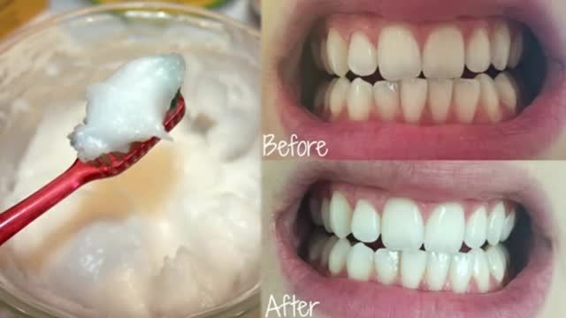 ترفندهای کاربردی که باعث سفید شدن دندان ها میشوند !