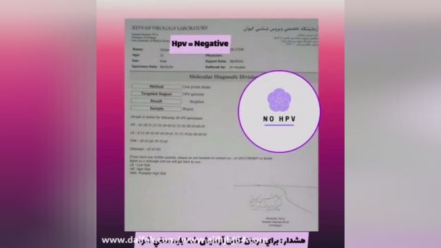 درمان تضمینی زگیل تناسلی hpv        .