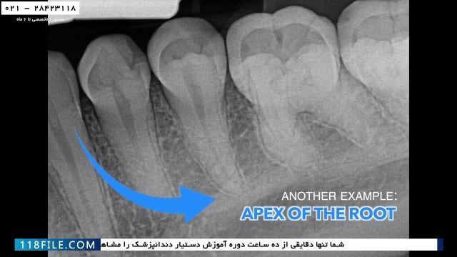 آموزش تکنسین دستیار دندانپزشک-دندانپزشکی جراحی-نحوه گرفتن عکس رادیولوژی دندان