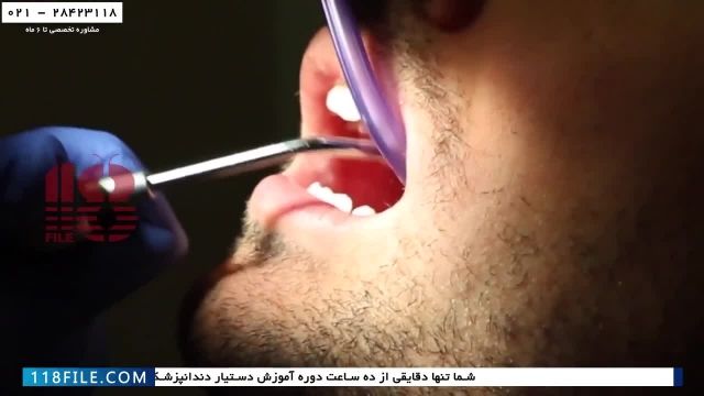 آموزش دستیار دندانپزشک - بی حسی و بیهوشی -چگونگی پر کردن دندان