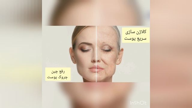 کلاژن سازی پوست صورت و جوانسازی