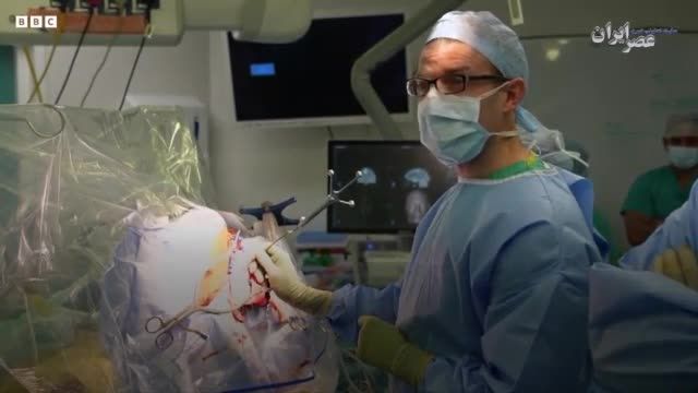 راهکار جدید برداشتن تومور مغزی در بیمارستان ادنبورک در کمبریج