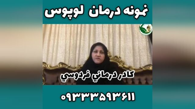 نمونه درمان لوپوس ❤????