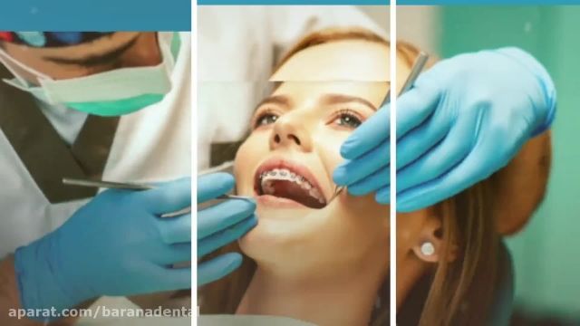انجام هر دو روش ارتودنسی و لمینت دندان