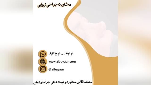 ویدی جراحی زیبای بینی در شهر تهران