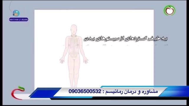 درمان رماتیسم زیرنظر علوم پزشکی مشهد