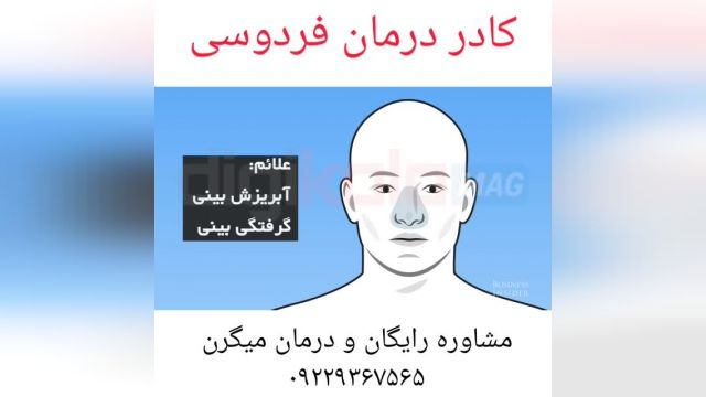 مشاوره و درمان کامل بیماری میگرن‌توسط کادر درمان فردوسی