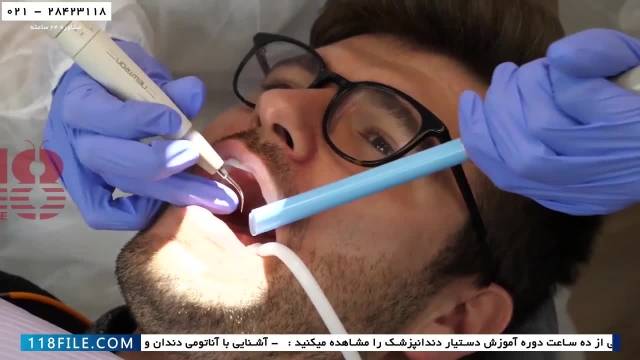 آموزش دستیاری دندانپزشک - آموزش دندانپزشکی - ( تمیز کردن بین دندان ها )