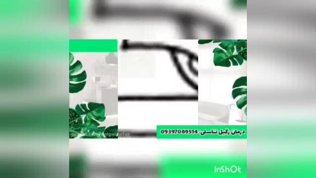 درمان زگیل تناسلی باروش جدید