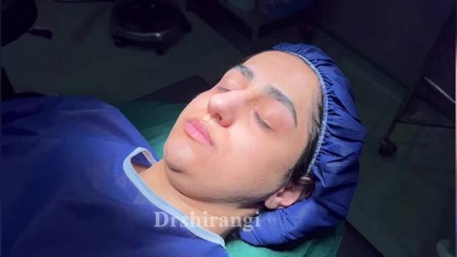 فیلم عمل بینی در اتاق عمل | دکتر سعید شیرنگی