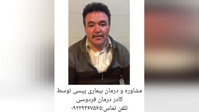 مصاحبه با فرد بهبودیافته پیسی توسط کادر درمان فردوسی.