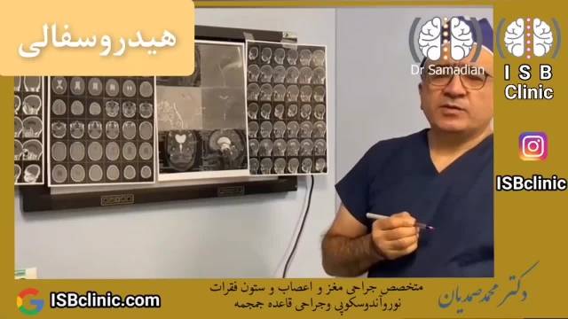 عمل جراحی ETV جهت درمان هیدروسفالی