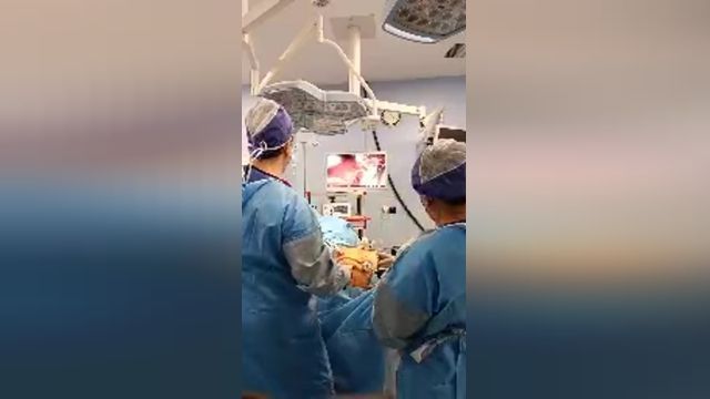 لایو جراحی بای پس معده توسط دکتر قدسی
