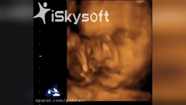 دانلود ویدیو و فیلم سونوگرافی هفته 32 بارداری