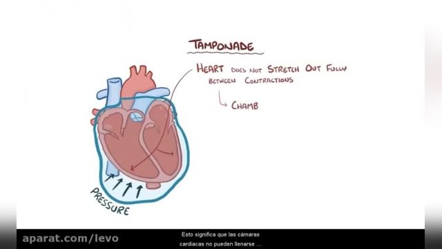 درباره تامپوناد قلبی چه میدانید؟