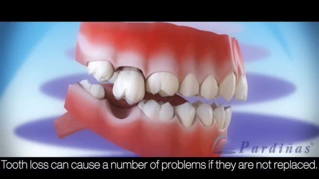 بی دندانی دارای چه عوارضی است؟