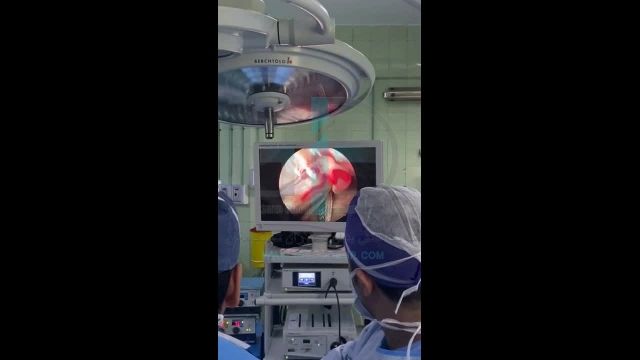 عمل جراحی دکتر رضا اشراقی با دوربین پزشکی (Surgical Camera)