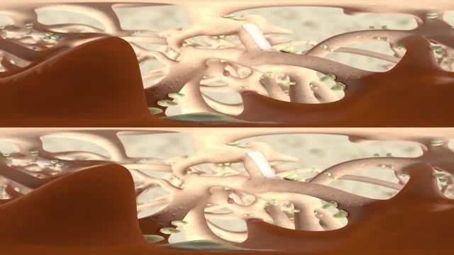 360 درجه VR تحلیل استخوان | ویدیو
