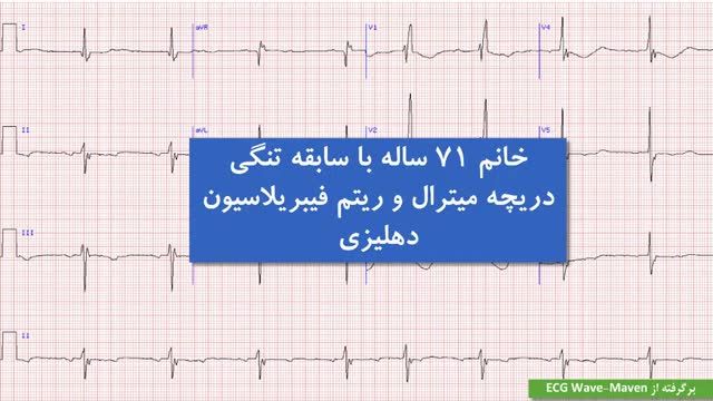 تمرین نوار قلب (الکتروکاردیوگرام) | بخش 6