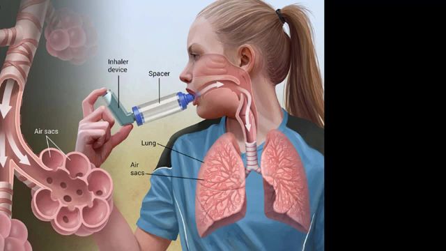 آسم یا تنگی نفس | آشنایی با علائم و درمان بیماری تنگی نفس