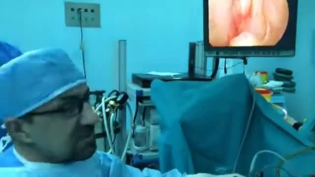 فیلم عمل پروستات به روش اندوسکوپی و بدون جراحی باز